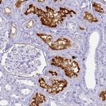 SLC7A9 Antibody in Immunohistochemistry (IHC)