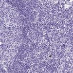 SLC7A9 Antibody in Immunohistochemistry (IHC)