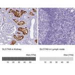 SLC7A9 Antibody