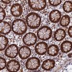 ZNF428 Antibody in Immunohistochemistry (Paraffin) (IHC (P))