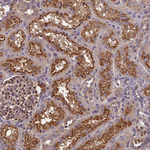 PIKFYVE Polyclonal Antibody