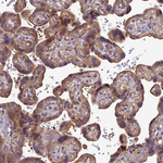 PIKFYVE Antibody in Immunohistochemistry (Paraffin) (IHC (P))