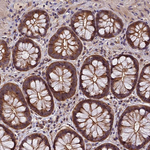 PIKFYVE Antibody in Immunohistochemistry (Paraffin) (IHC (P))