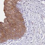 GK5 Polyclonal Antibody
