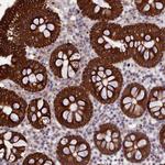 PET112 Antibody in Immunohistochemistry (Paraffin) (IHC (P))