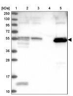 PET112 Antibody in Western Blot (WB)