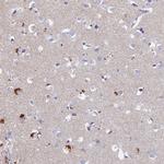 PAPL Antibody in Immunohistochemistry (Paraffin) (IHC (P))