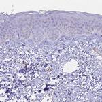 CENPV Antibody in Immunohistochemistry (Paraffin) (IHC (P))