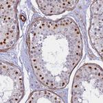 CENPV Polyclonal Antibody