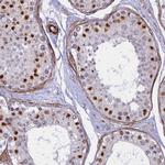 CENPV Antibody in Immunohistochemistry (IHC)