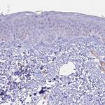 CENPV Antibody in Immunohistochemistry (IHC)