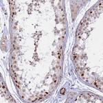 CENPV Antibody in Immunohistochemistry (IHC)