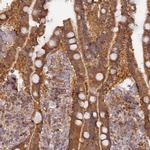 RPIA Antibody in Immunohistochemistry (Paraffin) (IHC (P))
