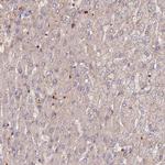 RPIA Antibody in Immunohistochemistry (Paraffin) (IHC (P))