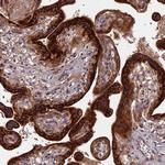 RPIA Antibody in Immunohistochemistry (Paraffin) (IHC (P))