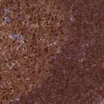 RPIA Polyclonal Antibody