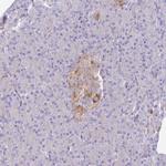 NALP9 Antibody in Immunohistochemistry (Paraffin) (IHC (P))