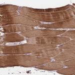 NALP9 Antibody in Immunohistochemistry (Paraffin) (IHC (P))