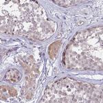 NALP9 Antibody in Immunohistochemistry (Paraffin) (IHC (P))