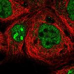 CCDC148 Polyclonal Antibody