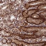 RBBP8NL Polyclonal Antibody