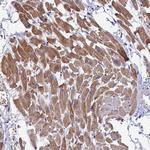 WDR83 Antibody in Immunohistochemistry (Paraffin) (IHC (P))