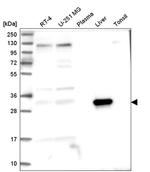 ASPDH Antibody in Western Blot (WB)