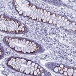 ERICH4 Polyclonal Antibody