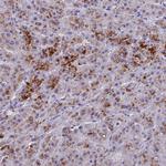 BTBD19 Polyclonal Antibody