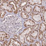 ARHGAP40 Antibody in Immunohistochemistry (Paraffin) (IHC (P))