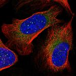 RARS2 Polyclonal Antibody