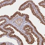 FAM210B Antibody in Immunohistochemistry (Paraffin) (IHC (P))