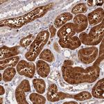 ASPDH Polyclonal Antibody