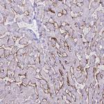 CD299 (DC-SIGN/L) Antibody in Immunohistochemistry (IHC)