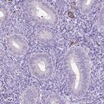 SIRP delta Antibody in Immunohistochemistry (IHC)