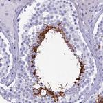 GAPDHS Antibody in Immunohistochemistry (Paraffin) (IHC (P))
