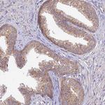 TMEM259 Polyclonal Antibody