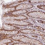 CYB5RL Antibody in Immunohistochemistry (Paraffin) (IHC (P))