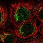 QIL1 Polyclonal Antibody