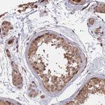 SAC3D1 Antibody in Immunohistochemistry (Paraffin) (IHC (P))