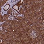 ANKRD39 Antibody in Immunohistochemistry (Paraffin) (IHC (P))