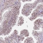 GBP2 Antibody in Immunohistochemistry (Paraffin) (IHC (P))