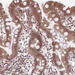 GBP2 Antibody in Immunohistochemistry (Paraffin) (IHC (P))