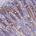 REEP4 Antibody in Immunohistochemistry (Paraffin) (IHC (P))