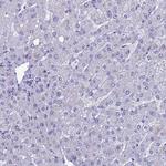 REEP4 Antibody in Immunohistochemistry (Paraffin) (IHC (P))