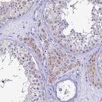 REEP4 Antibody in Immunohistochemistry (Paraffin) (IHC (P))