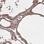 ING5 Polyclonal Antibody