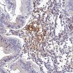 CLEC11A Antibody in Immunohistochemistry (Paraffin) (IHC (P))