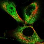 PKIG Polyclonal Antibody