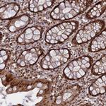 PKIG Antibody in Immunohistochemistry (Paraffin) (IHC (P))